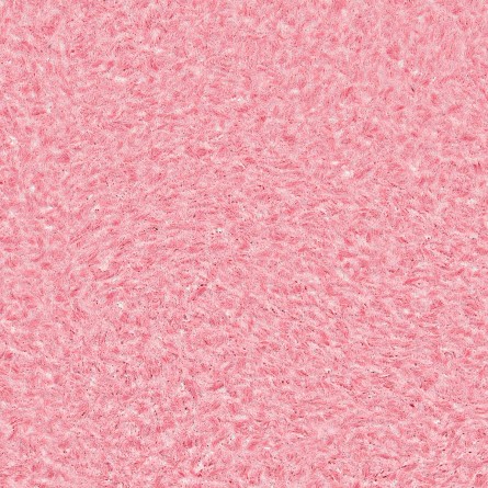 Жидкие обои (декоративная штукатурка) Pink 295 Жидкие обои (декоративная штукатурка) Pink 295